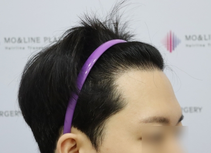 치료후기 이미지